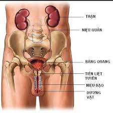Dị tật đường tiết niệu - Hình ảnh minh họa